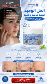 Coopérative Casa Cosmétique Y Creme Hobob acne treatment jar with white cream and blue label on white background